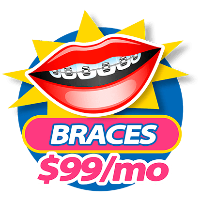 Dental Braces for $99 a month at Somos Dental
